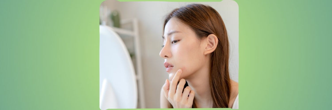 Decoding Period Acne: Makeup Strategies for Business and Study