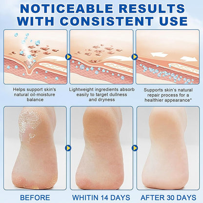 60% Urea Repair Cream for Cracked Heels, Calluses & Rough Skin