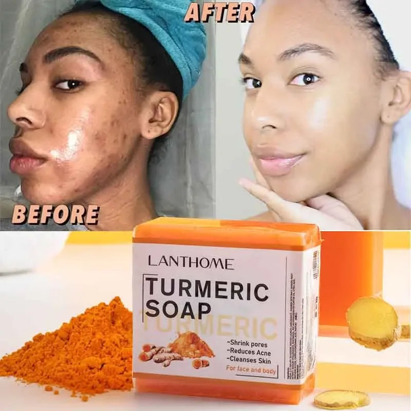 Turmeric Face & Body Soap for Anti-Acne & Brightening