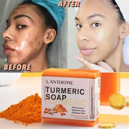 Turmeric Face & Body Soap for Anti-Acne & Brightening