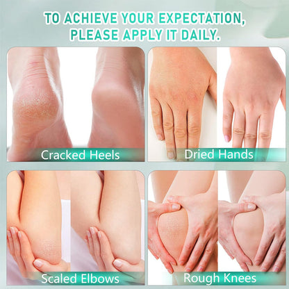 Tea Tree Intensive Repair Foot Cream for Cracked Heels, Dry Skin & Smooth Feet